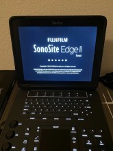 SonoSite EDGE II Portable Utrasound Machine