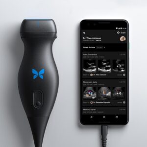 butterfly iq portable ultrasound