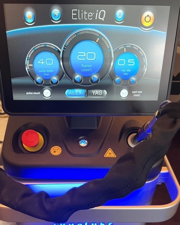 Cynosure Elite IQ 2022 1 Cynosure Elite IQ