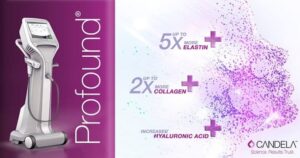 syneron candela profound