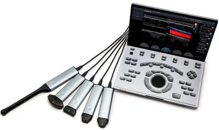 Chison SonoAir Ultrasound